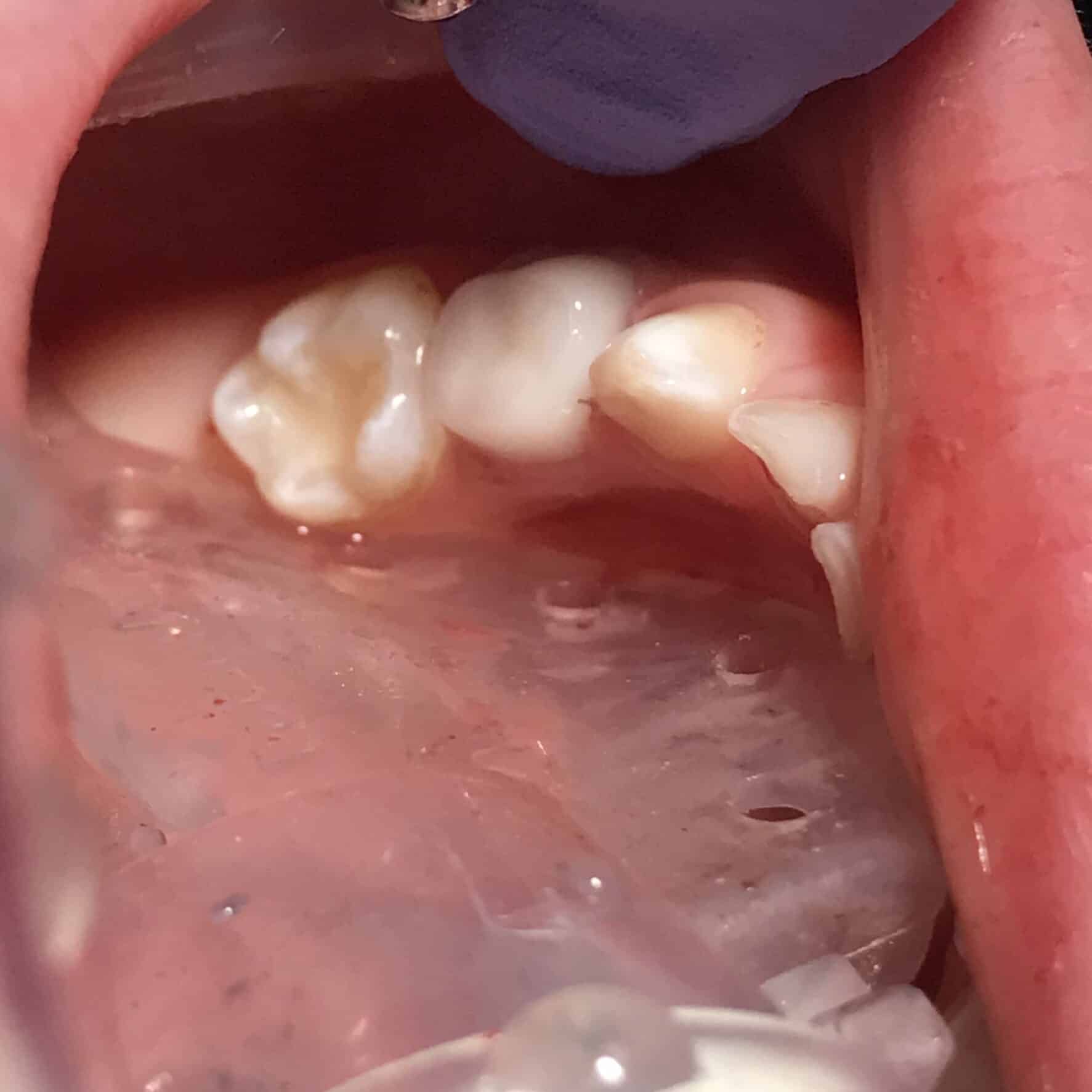 Dental picture taken inside the mouth